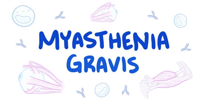 myasthenia-gravis-alanya