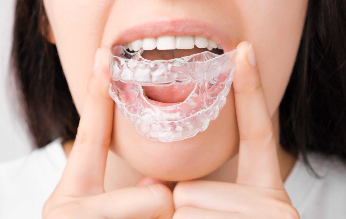 Does Teeth Grinding (Bruxism) Cause Headaches and How Is Botox Applied in Its Treatment?